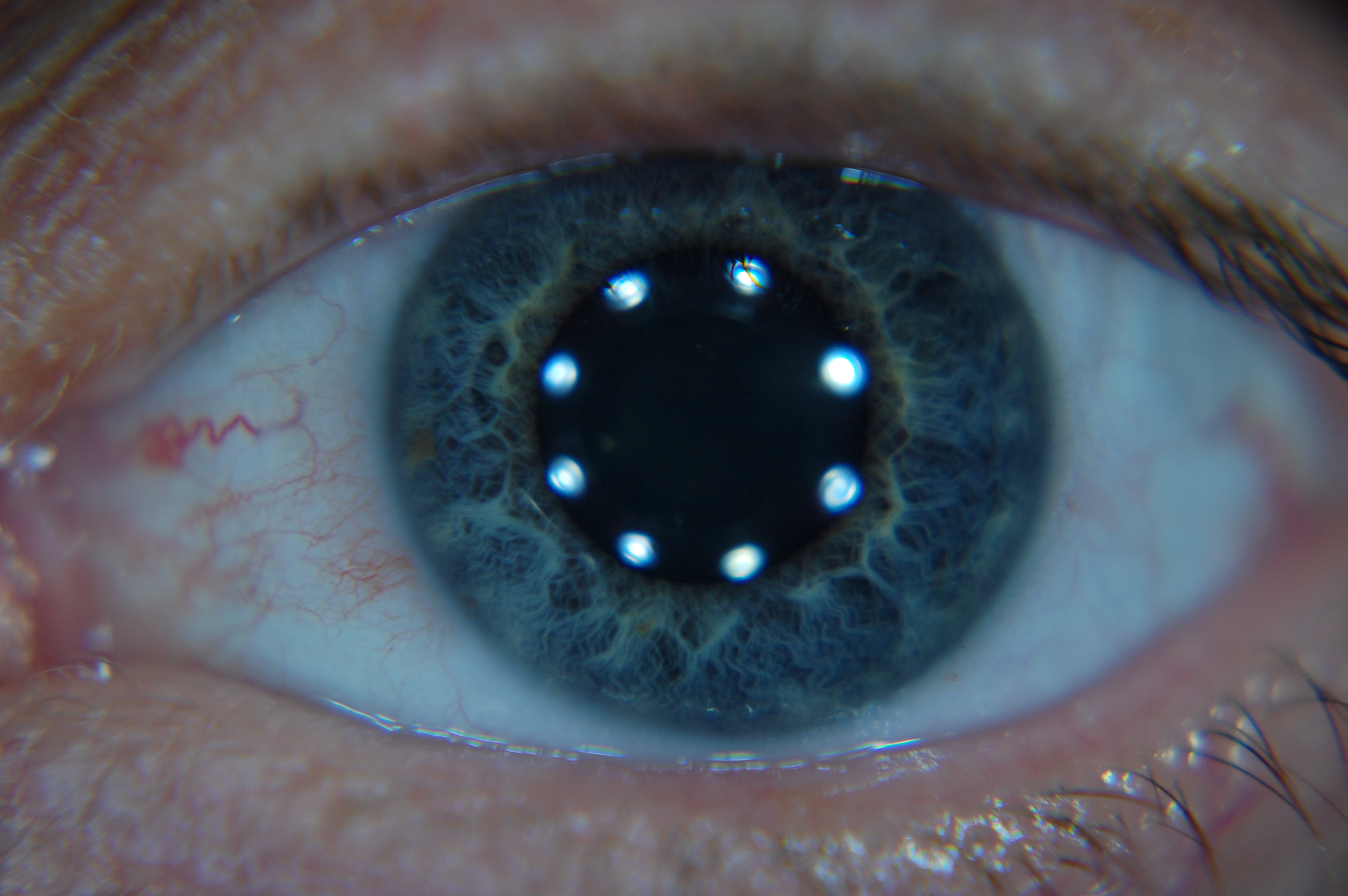 Ojo con las estrellas